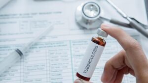 Menyingkap TBC: Memahami, Mengobati, dan Mencegah Penyakit Mematikan Ini